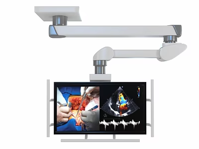 Smart Medical Display Machine With Articulated Arm Shows Surgical 3d model