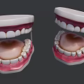 Anatomical Dental Models With Upper Lower Jaw Teeth And Gum Structure