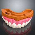 Dental Teeth Model With Pink Gums White Teeth And Orange Orthodontic Tray
