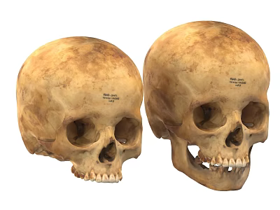 Two Human Skulls Displaying Cranial Structure And Dental Features Anatomically 3d model