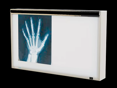 Medical Device X Ray Viewer for Viewing Hand Skeleton Radiograph Film 3d model
