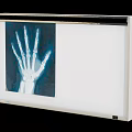 Medical Device X Ray Viewer for Viewing Hand Skeleton Radiograph Film