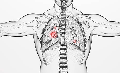 modern human lung disease 3d model