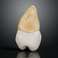 Anatomical Human Tooth Structure Featuring White Base And Yellow Ceramic Crown Part 3d model