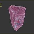 3D Medical Device Anatomical Model with Pink Exterior and Internal Vascular Structures