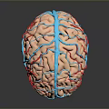 Advanced Medical Device for Brain Vessel Visualization Using 3D Modeling Technology