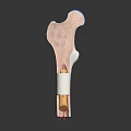 Human Bone Organ Structure Displaying Diaphysis Epiphysis And Marrow Cavity Details