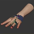 Human Hand With Blue Support Brace For Finger Stabilization And Rehabilitation