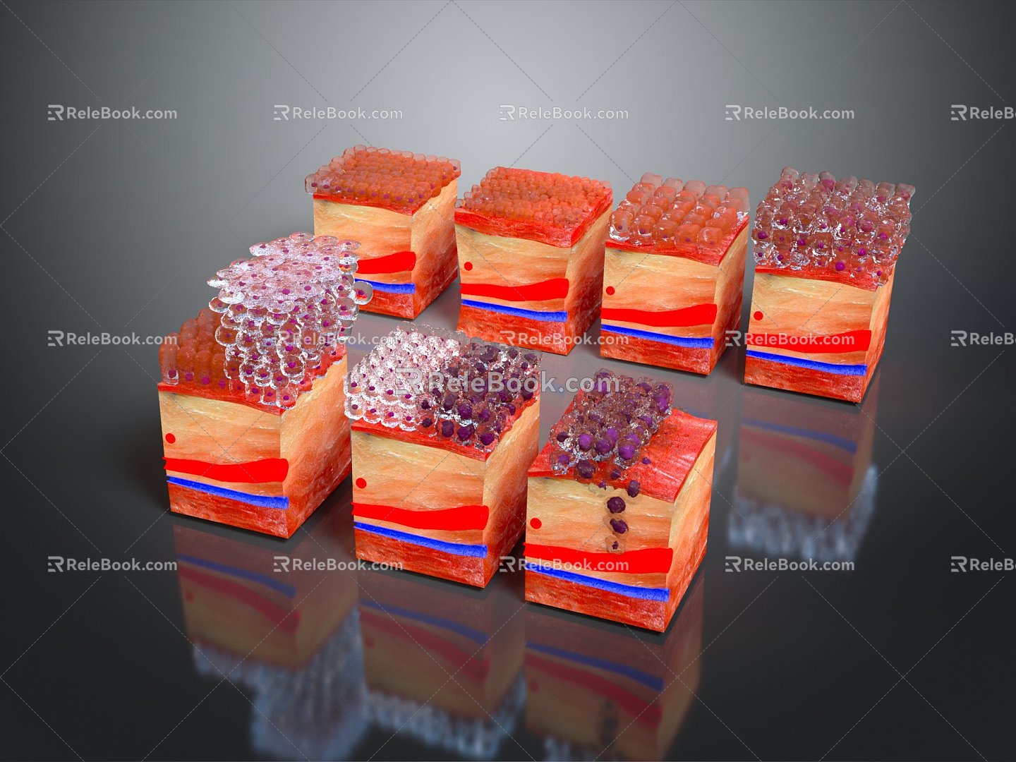 Modern Epithelial Cell Cancer Skin Anatomical Organs 3d model