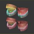 Anatomical Head Organ Models Displaying Teeth Gums And Tongue From Various Angles