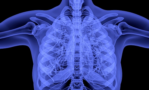 Modern thoracic and pulmonary bacterial infections 3d model