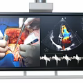 Smart Medical Display Machine With Articulated Arm Shows Surgical