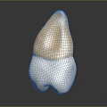 Anatomical Human Tooth Structure Featuring White Base And Yellow Ceramic Crown Part 3d model