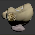 Knee Joint Medical Device 3D Model for Orthopedic Implant and Surgical Planning