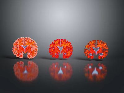 Medical Devices Three 3D Red Anatomical Brain Models with Reflective Surfaces on Gray Background 3d model