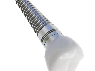 Dental Implant Medical Device For Orthodontic Surgery With Titanium Screw And Ceramic Crown 3d model