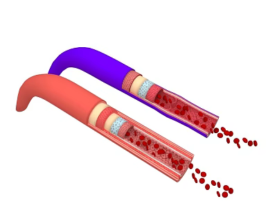 Red And Purple Blood Vessels With Inner Layers And Blood Cells Flowing Out 3d model