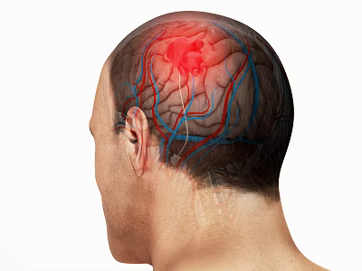 Medical Devices For Brain Region Visualization With Cerebral Vessels And Highlighted Areas 3d model