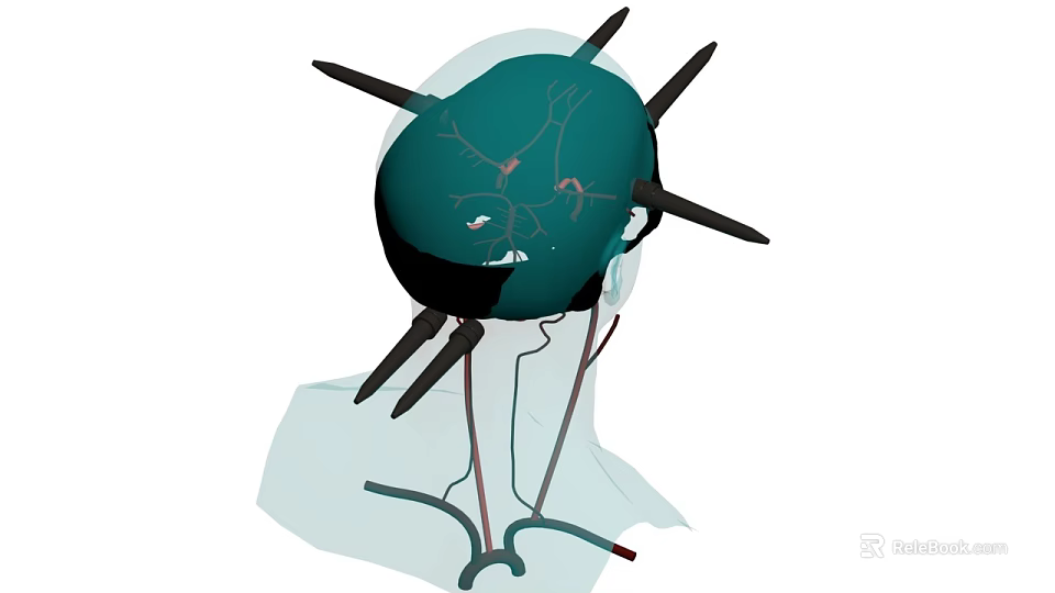 Head Organ Illustration With Green Structure Black Spike Like Protrusions And Red Lines 3d model 
