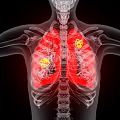 Innovative Medical Devices for High Resolution Lung Imaging and Diagnostic Visualization 3d model