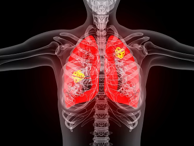 Innovative Medical Devices for High Resolution Lung Imaging and Diagnostic Visualization 3d model