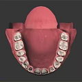 Anatomically Accurate Dental Organ Model With Pink Gum And White Teeth Structure