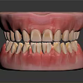 Detailed Dental Model Of Tooth And Gum Displaying Oral Organ Structure