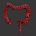 3D Medical Illustration of Human Intestinal Anatomy Model with Red Inflamed Areas