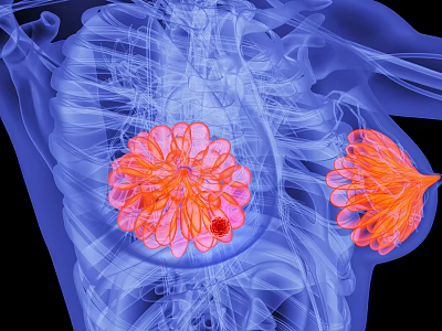 High Precision Medical Device for Breast Cancer Detection with 3D Imaging Technology 3d model