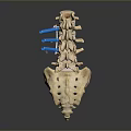 Animal Spine Skeleton With Blue Orthopedic Support Rods And Detailed Bone Structure