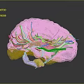 Transparent Brain Model with Hair like Structures and Purple Yellow Components 3d model