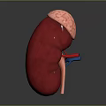 Medical Device 3D Anatomical Kidney Model for Medical Education Detailed Structure