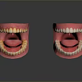 Anatomical 3D Model of Human Oral Organs Showing Teeth Gums and Tongue Structure