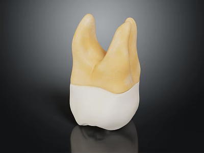 Dental Crown Model with Yellow Upper Part and White Lower Base for Dental Restoration 3d model