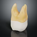 Dental Crown Model with Yellow Upper Part and White Lower Base for Dental Restoration