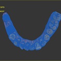 Dental Implant Modern Teeth 3d model