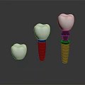 Dental Implant Medical Devices With Three White Crowns And Metal Screws