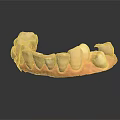 Dental Teeth Model With White Restored Teeth And Pink Gum Base For Dental Study