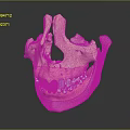 Human Skull Oral Anatomy Model With Detailed Teeth And Pink Gums