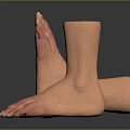 Man With Amputated Ankle Prosthetic Foot And Red Skin Areas On Feet
