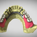 Detailed Dental Organ Prosthesis Models Featuring Crowns Bridges Abutments And Arch Structures