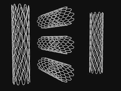 High Quality Medical Devices Mesh Stents Various Shapes For Implantable Use 3d model