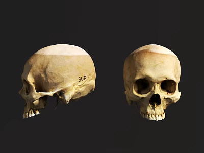 Human Skulls Anatomical Structure With Natural Bone Texture And Front Side Views 3d model