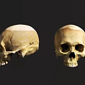 Human Skulls Anatomical Structure With Natural Bone Texture And Front Side Views