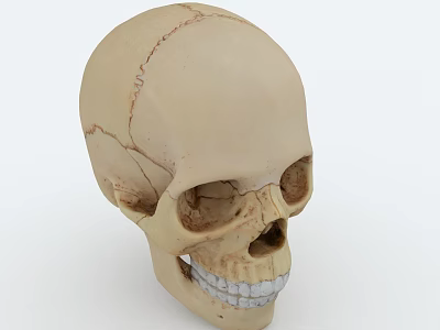 Beige Human Skull Model With Cracked Surface And Visible Teeth 3d model