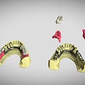 Detailed Dental Organ Prosthesis Models Featuring Crowns Bridges Abutments And Arch Structures