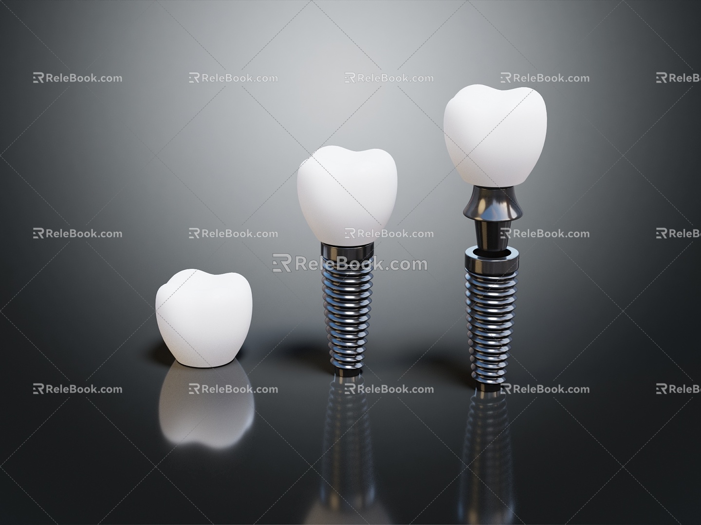 Modern Dental Implant Dental Implant 3d model