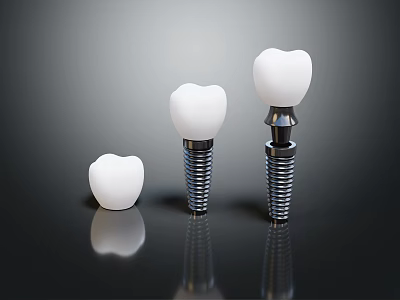 Dental Implant Medical Devices With Three White Crowns And Metal Screws 3d model