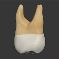 Dental Crown Model with Yellow Upper Part and White Lower Base for Dental Restoration