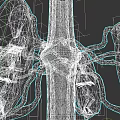 3D Rendering of Human Lungs with Bronchial Structure and Vascular Network